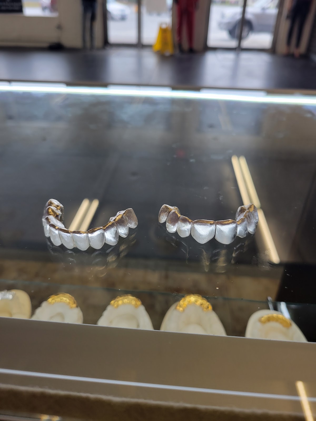 True Gold Grillz photo 3